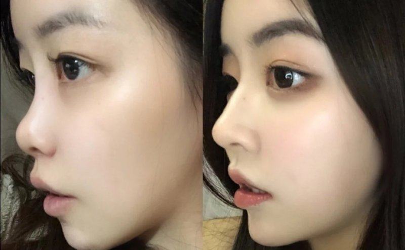 fine医院口碑评价