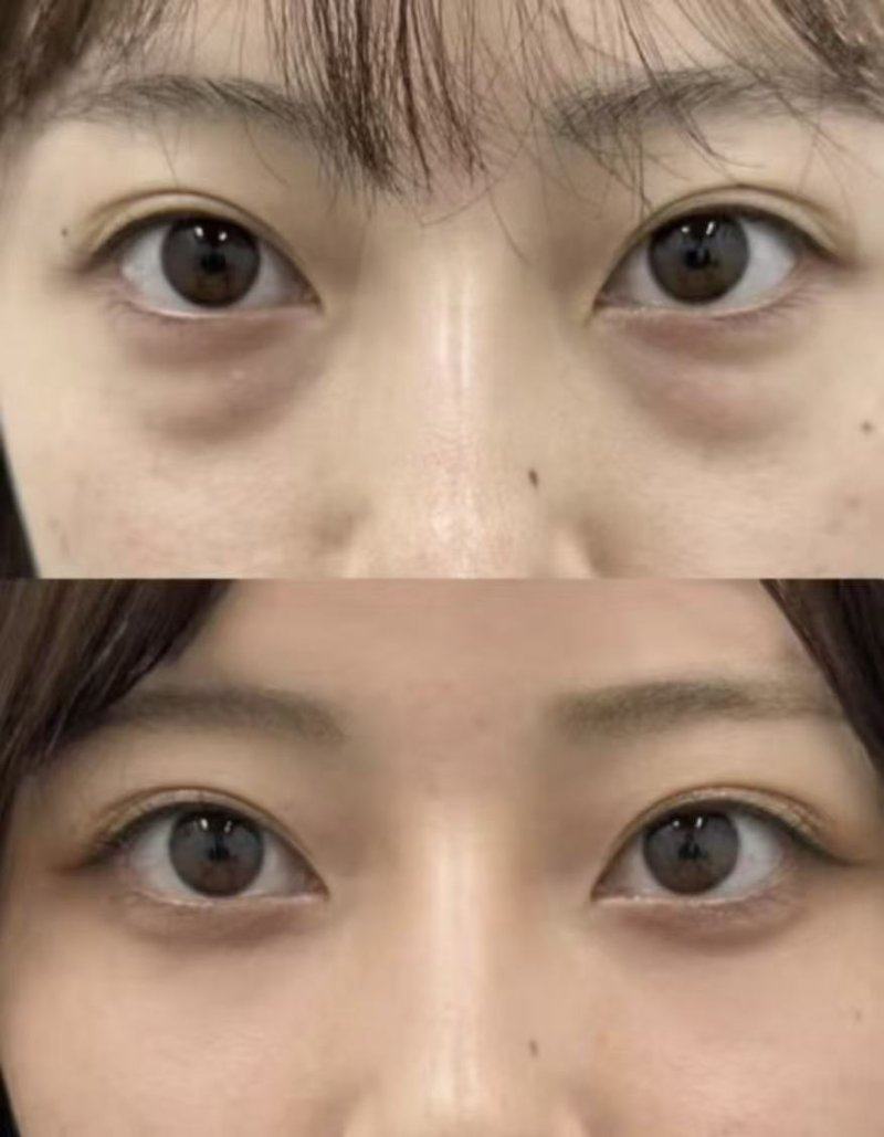 阜阳临泉残疾人修复医院地址电话及营业时间：