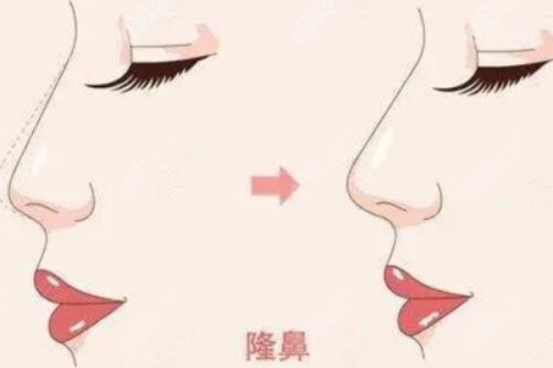 袁青医生怎么预约