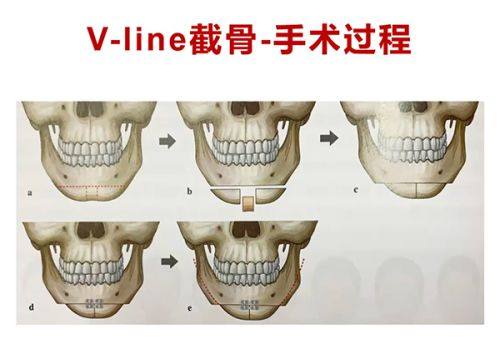 南充阆中阿蓝整形医院怎么样？