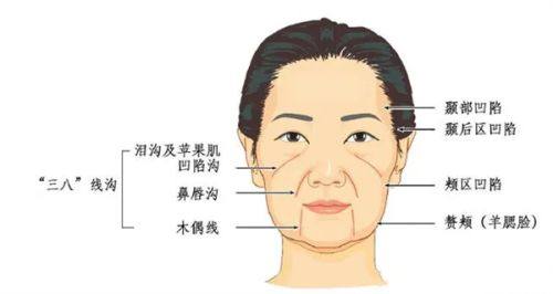 二、这些情况属于正常修复范畴