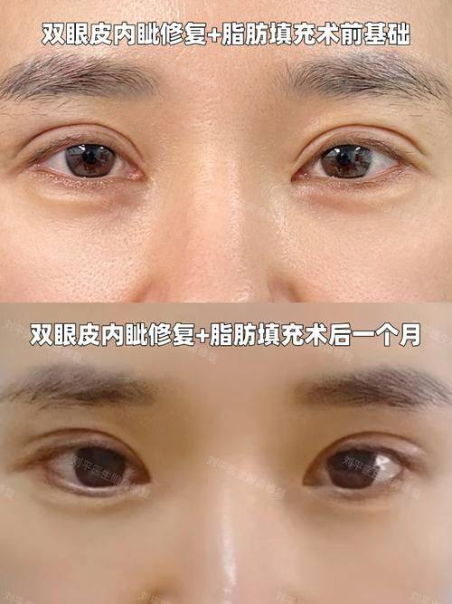 吉林大学第二医院皮肤美容中 心预约挂号方式：