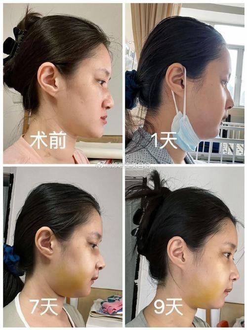 南京医科大学友谊整形外科医院镇江门诊部怎么样?