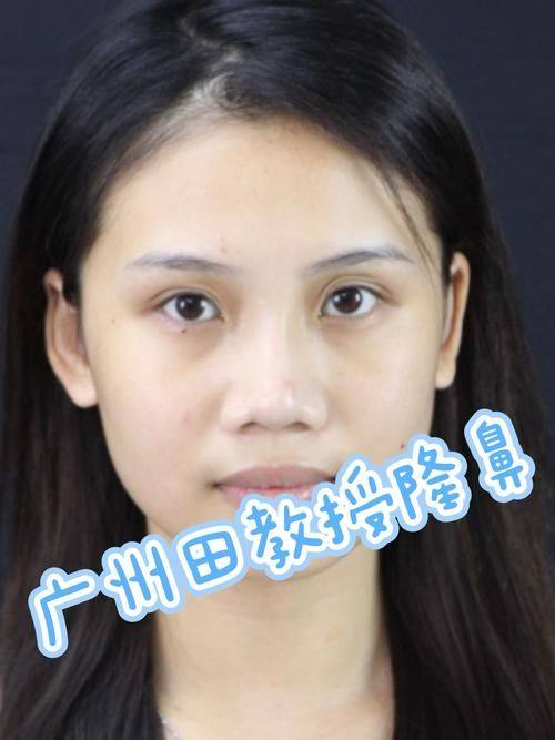 沈阳医 科 大学附属盛京医院价格表: