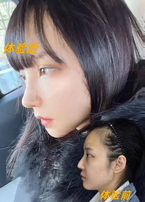 南京鼓楼医院集团仪征医院医疗美容科擅长项目：