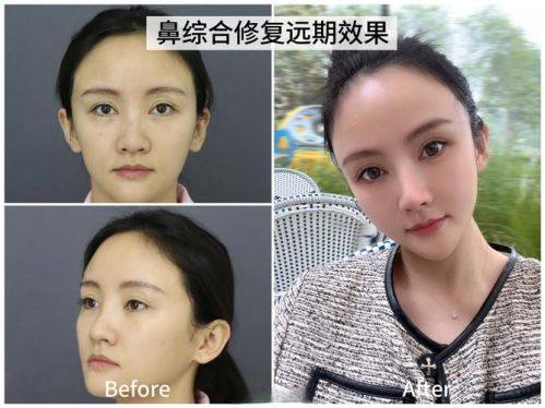 南京鼓楼医院集团仪征医院医疗美容科口碑评价