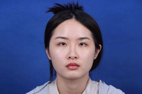 南京鼓楼医院集团仪征医院医疗美容科价格表