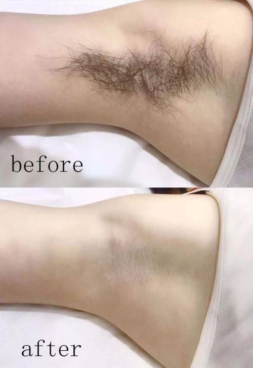 江西景德镇亚菲医疗美容门诊部擅长项目：