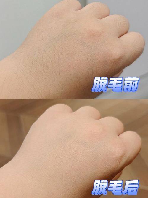 广州德馨整形医院擅长项目：