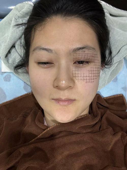 常州柏美医疗美容门诊口碑评价：