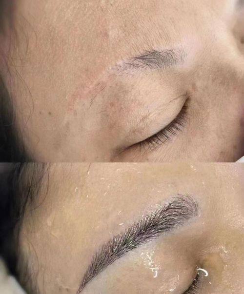 南京鼓楼医院集团仪征医院医疗美容科怎么样？