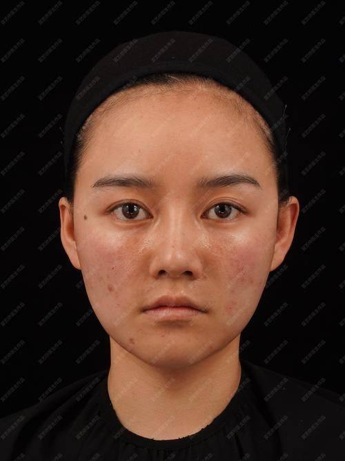 沈阳医 科 大学附属盛京医院医生名单及擅长领域: