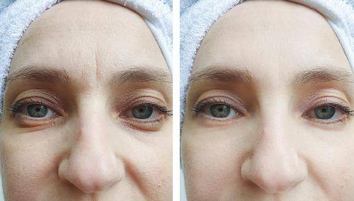 广州德馨整形医院怎么样？