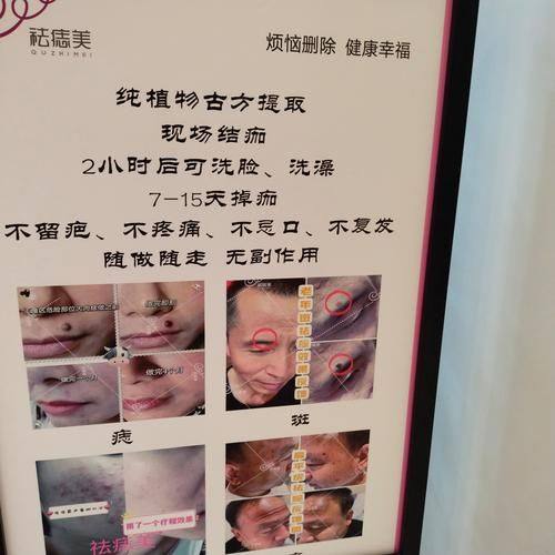 广州德馨整形医院口碑评价：