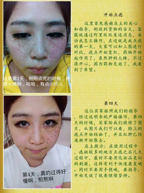 谢诗思医生技术优势