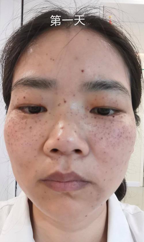 深圳联合会美整形医学美容门诊部地址电话及营业时间：