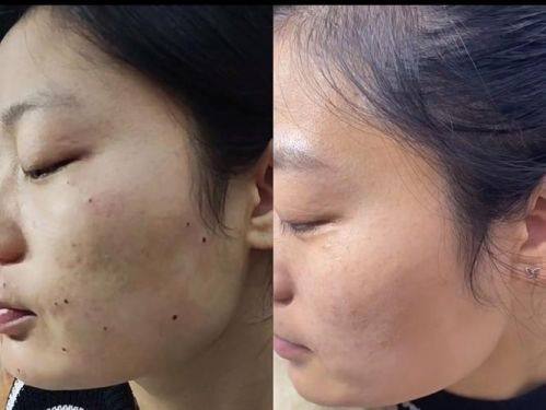 深圳联合会美整形医学美容门诊部预约挂号方式：