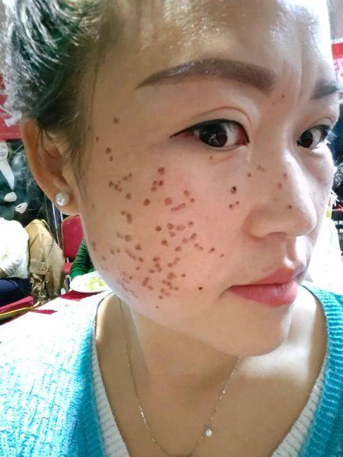 南充阆中阿蓝整形医院擅长项目：