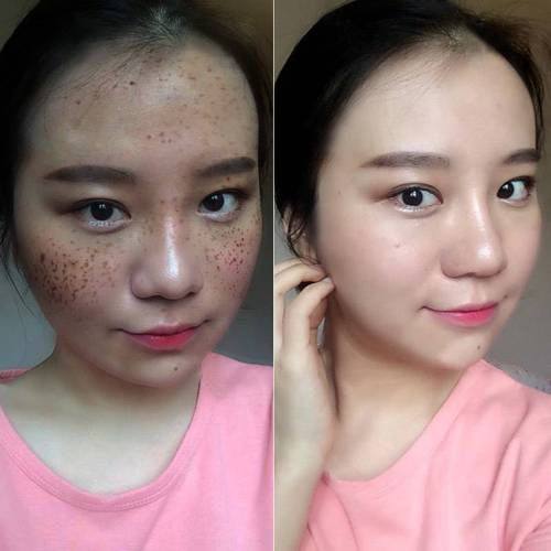 广州德馨整形医院地址电话及营业时间：