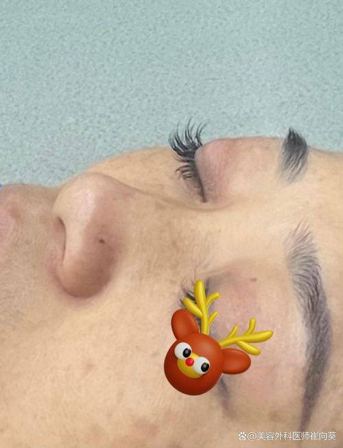 武汉匠星医疗美容门诊预约挂号方式