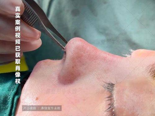 郑州芳艺整形医院地址电话及营业时间：