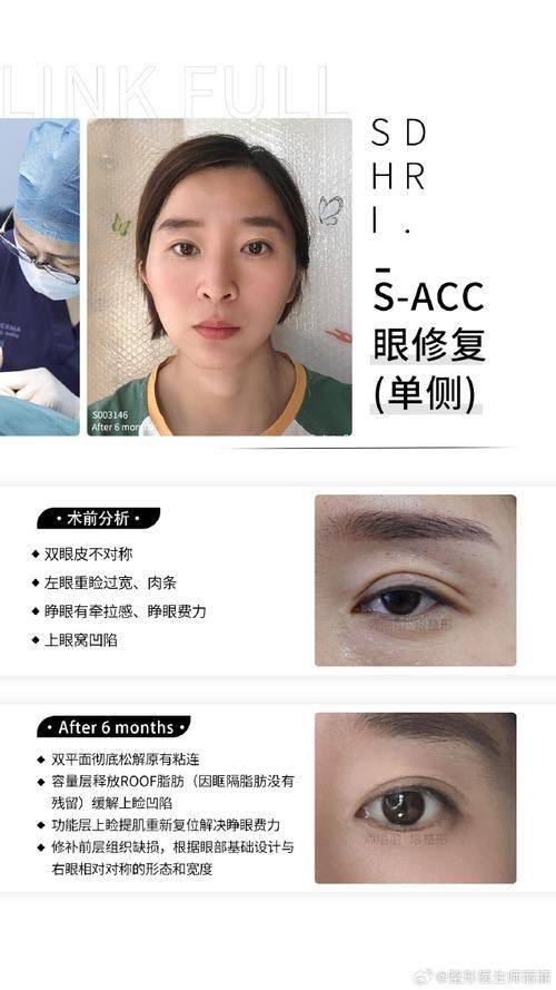 郑州芳艺整形医院擅长项目：