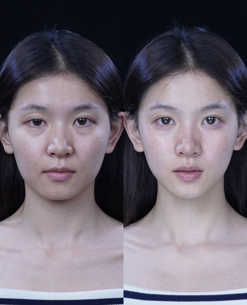 郑云豪医生技术优势