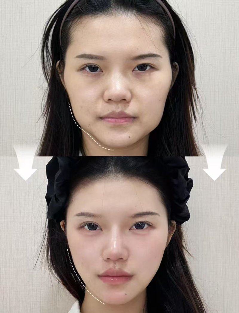 泉州上水医疗美容诊所口碑评价：