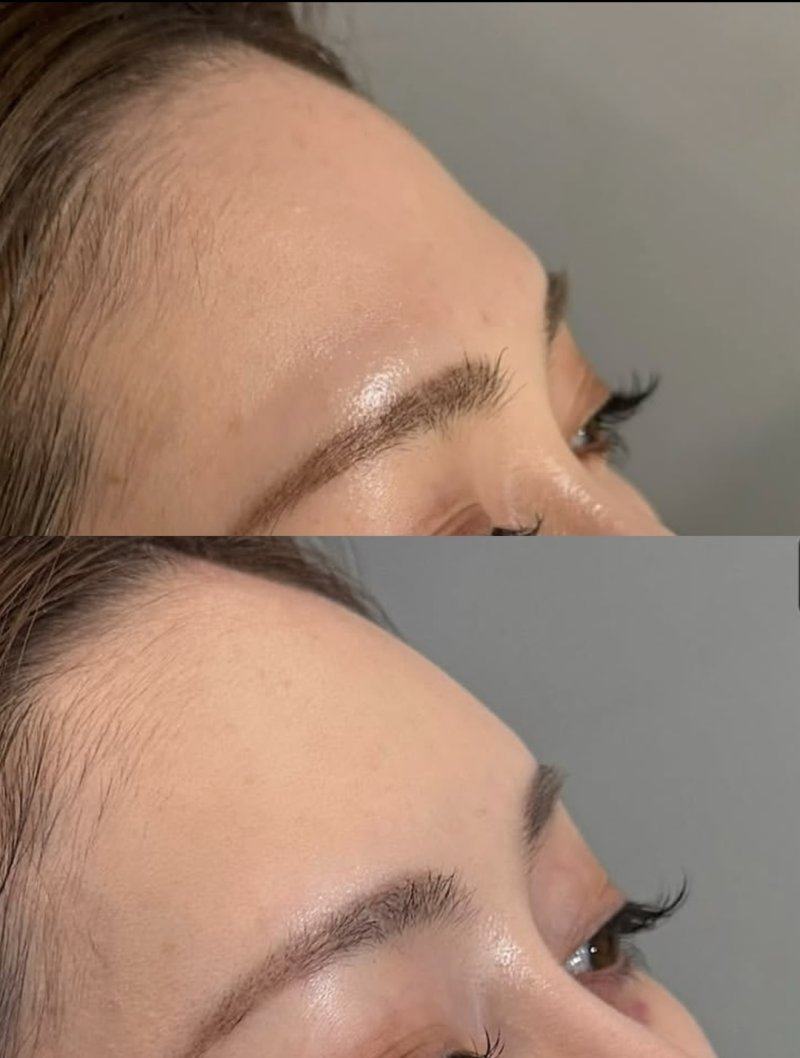 台州椒江睿仕医疗美容门诊部价格表: