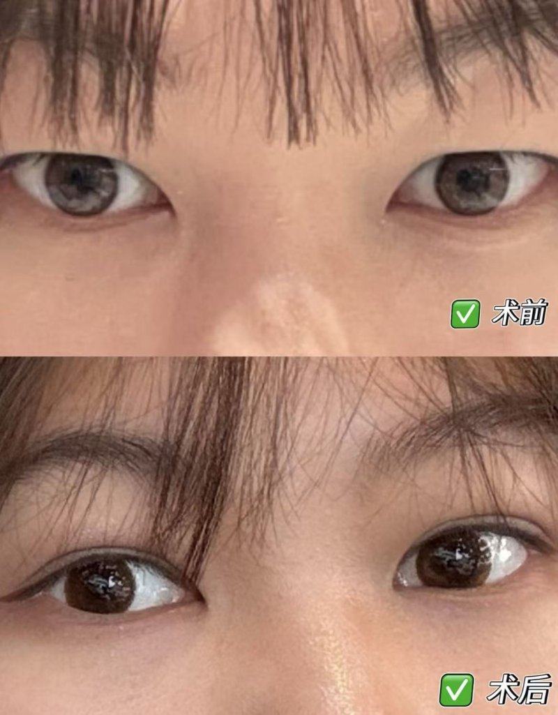 深圳联合会美整形医学美容门诊部价格表：