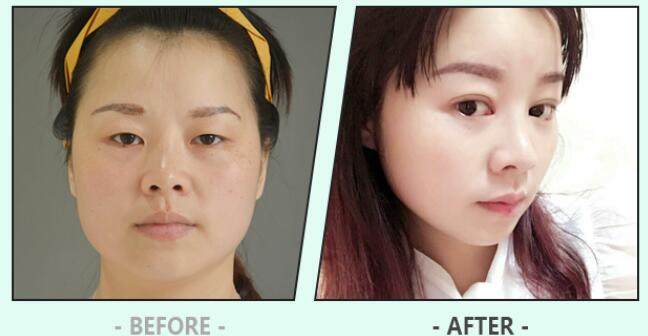 余班林医生口碑评价