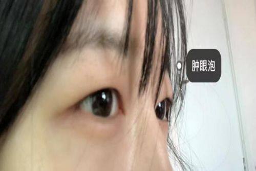 普洱恩雅医疗美容诊所怎么样？