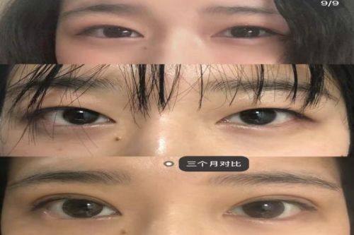 鹤岗李竹敏整形医院价格表