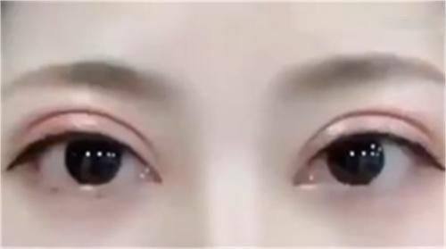 二、普通疤痕的黄金修复期