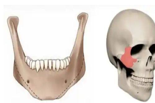 三、老太婆割双眼皮的趣味变体：想返老还童却露了馅