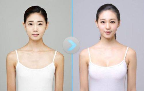 桂林时光医疗整形美容怎么样？