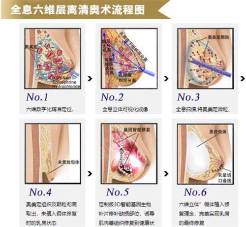 三、儿童疤痕的至佳修复时机