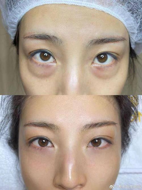 营口经济技术开发区美绣医疗美容诊所口碑评价: