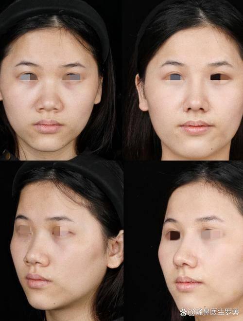 鹤岗李竹敏整形医院口碑评价