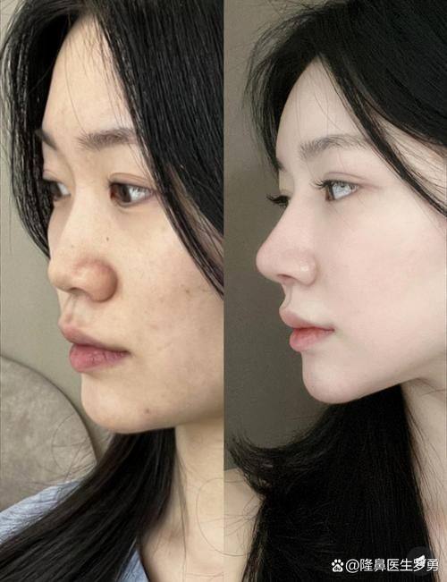 深圳丽格云发医疗美容诊所怎么样？