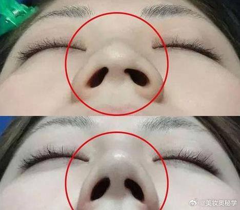 韩国哈娜儿整形外科擅长项目：