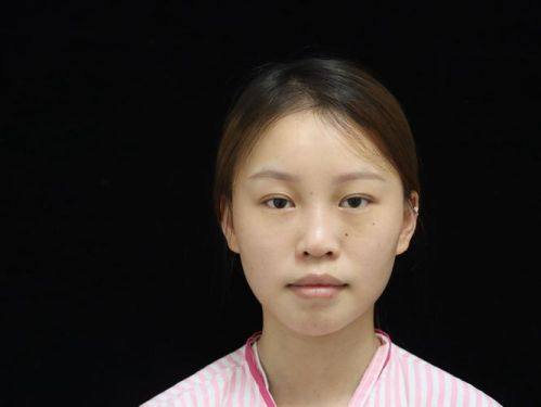 南通美贝尔医疗美容价格表：