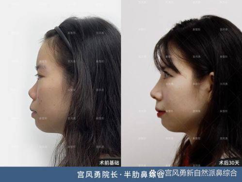 青岛华颜美医疗整形医院预约挂号方式：