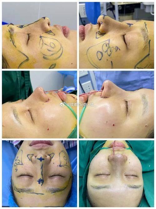 桂林时光医疗整形美容价格表：