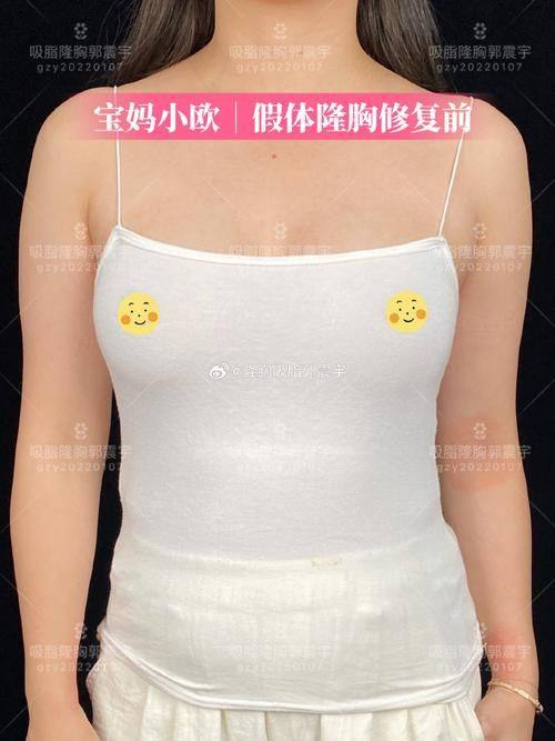 宁波舒禾医疗美容诊所擅长项目