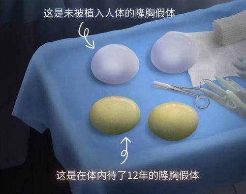 青岛华颜美医疗整形医院口碑评价：