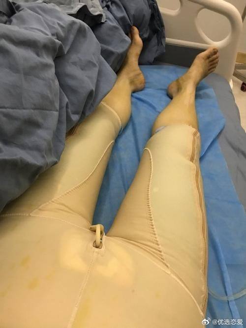 青岛华颜美医疗整形医院擅长项目：