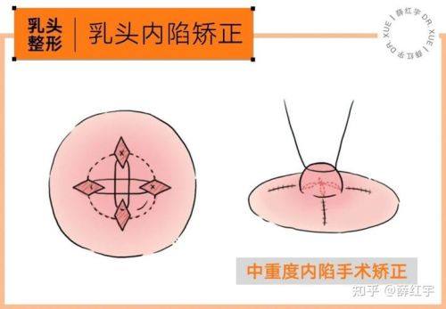 昆明肌妍医疗美容诊所价格表：