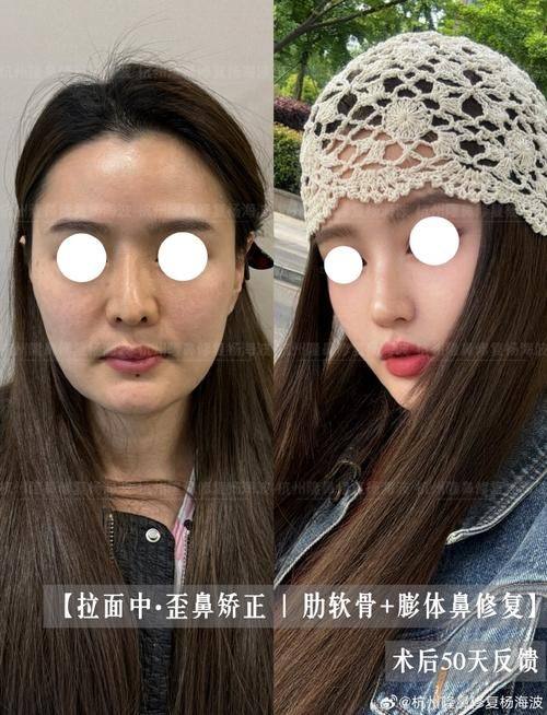 韩国哈娜儿整形外科地址电话及营业时间：