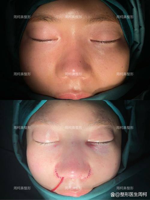 青岛博美医疗美容诊所怎么样？